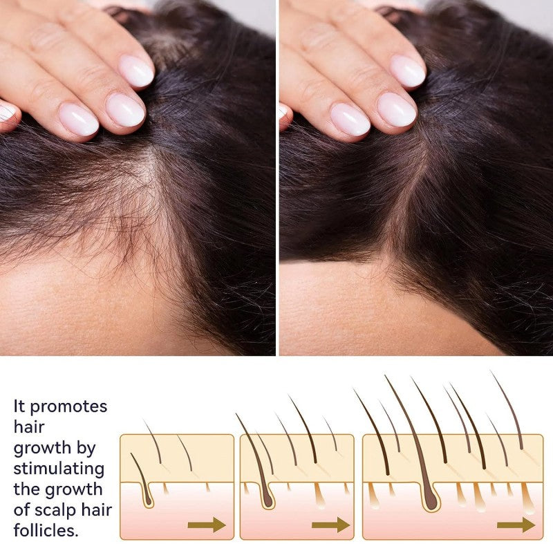 FEG Organic Hair Growth Treatment Oil 🌿✨