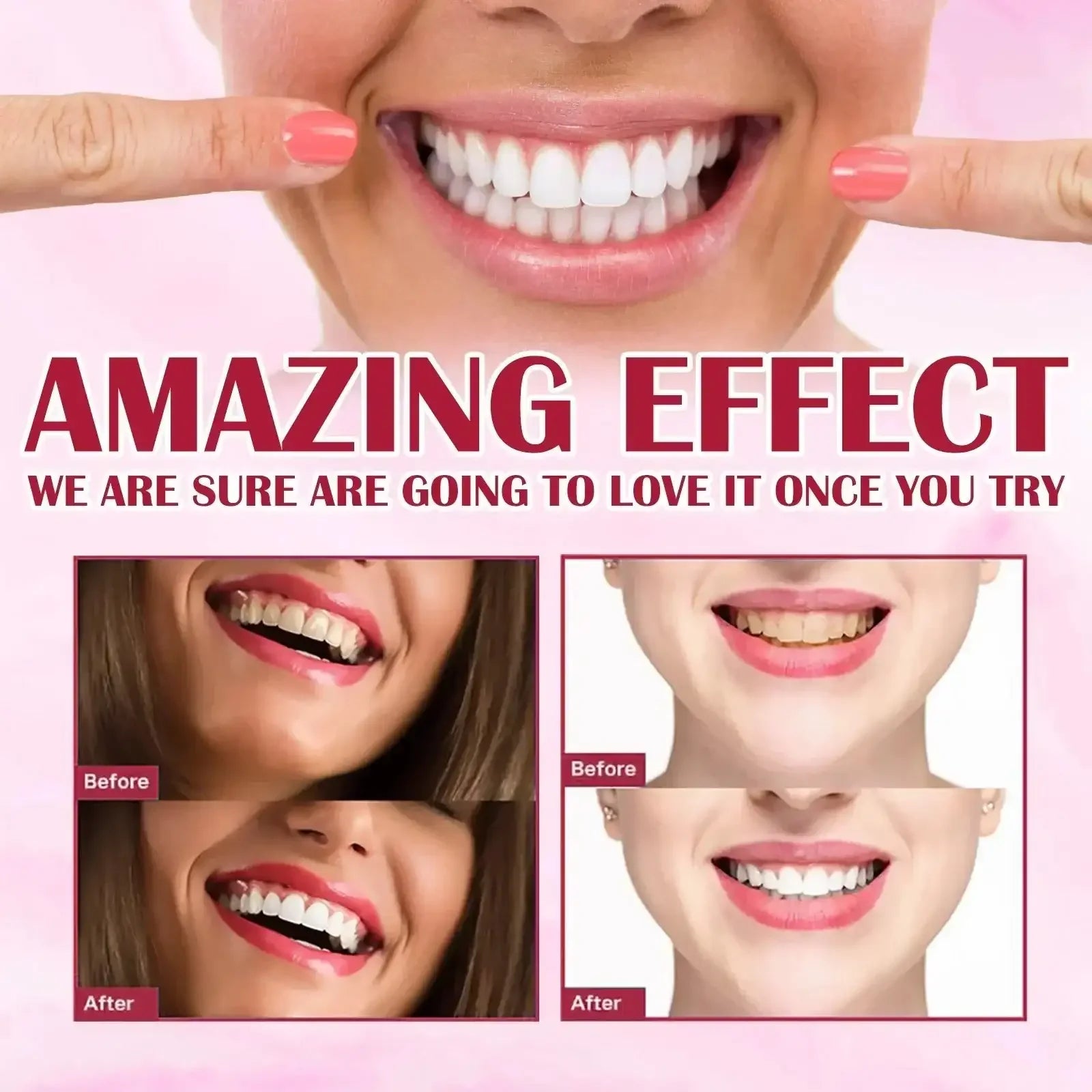 Yayashi SP4 Oral Care Probiotic Whitening Toothpaste 120g – Shine Brighter, Remove Years of Coffee, Tea & Smoking Stains Big Mart