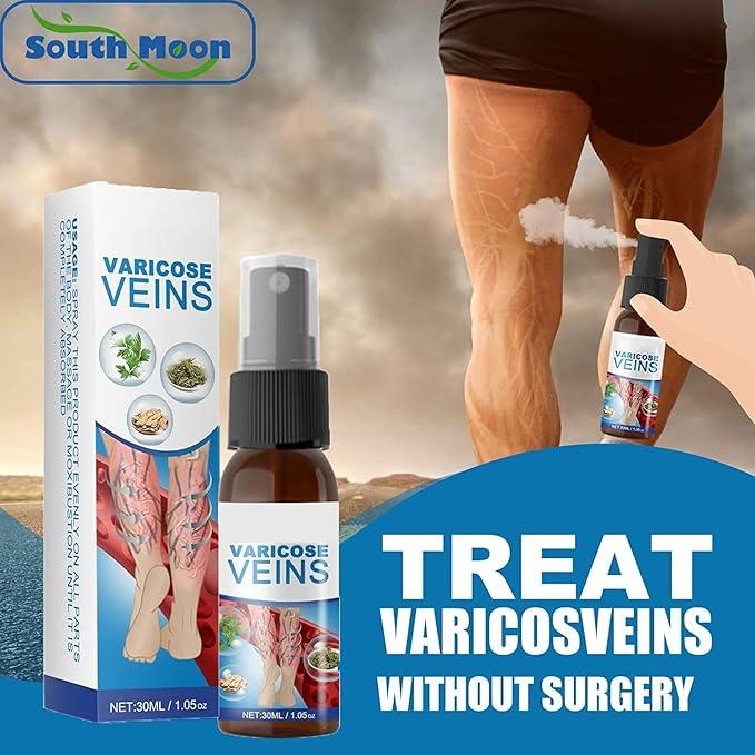 Varicose Veins Treatment Big Mart