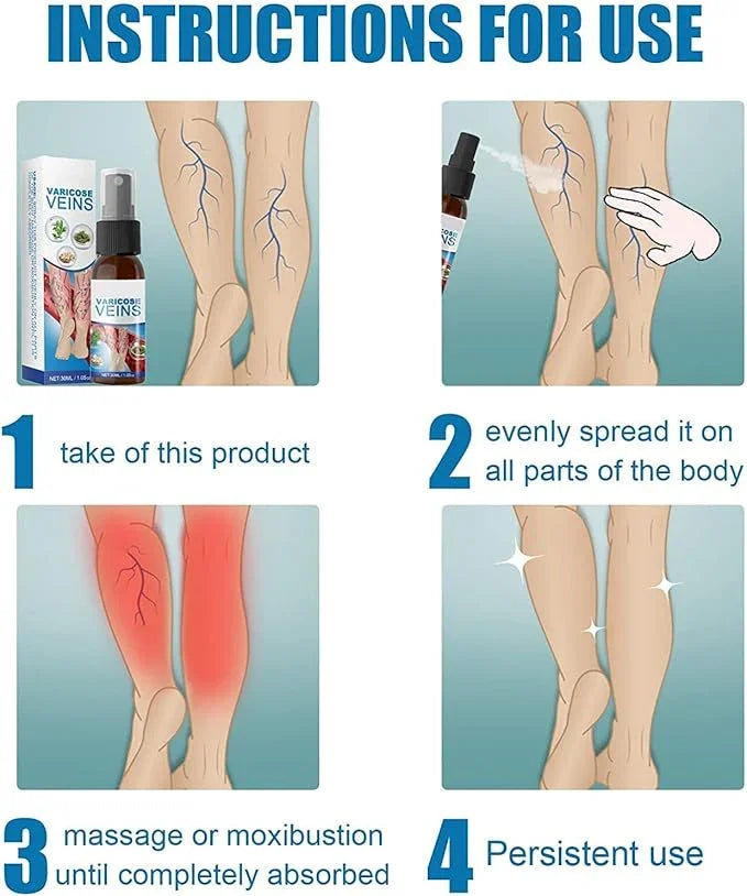 Varicose Veins Treatment Big Mart