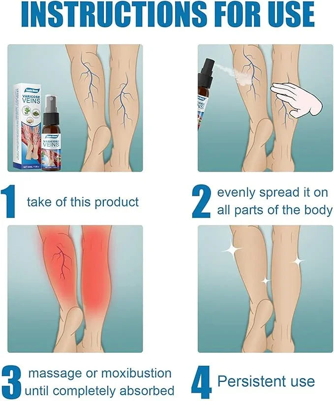 Varicose Veins Treatment Big Mart