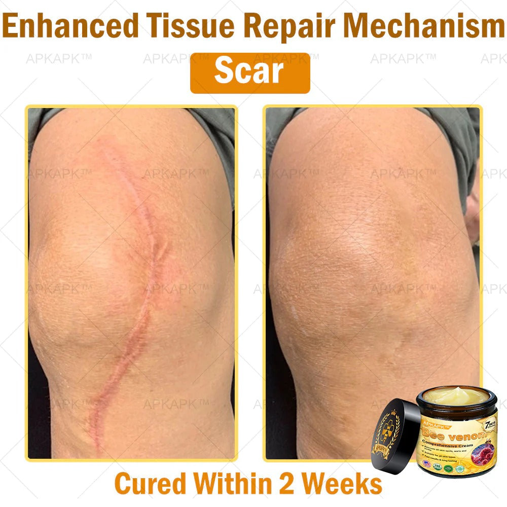 Bee Venom Repair Cream – Advanced Skin Repair for Face & Body