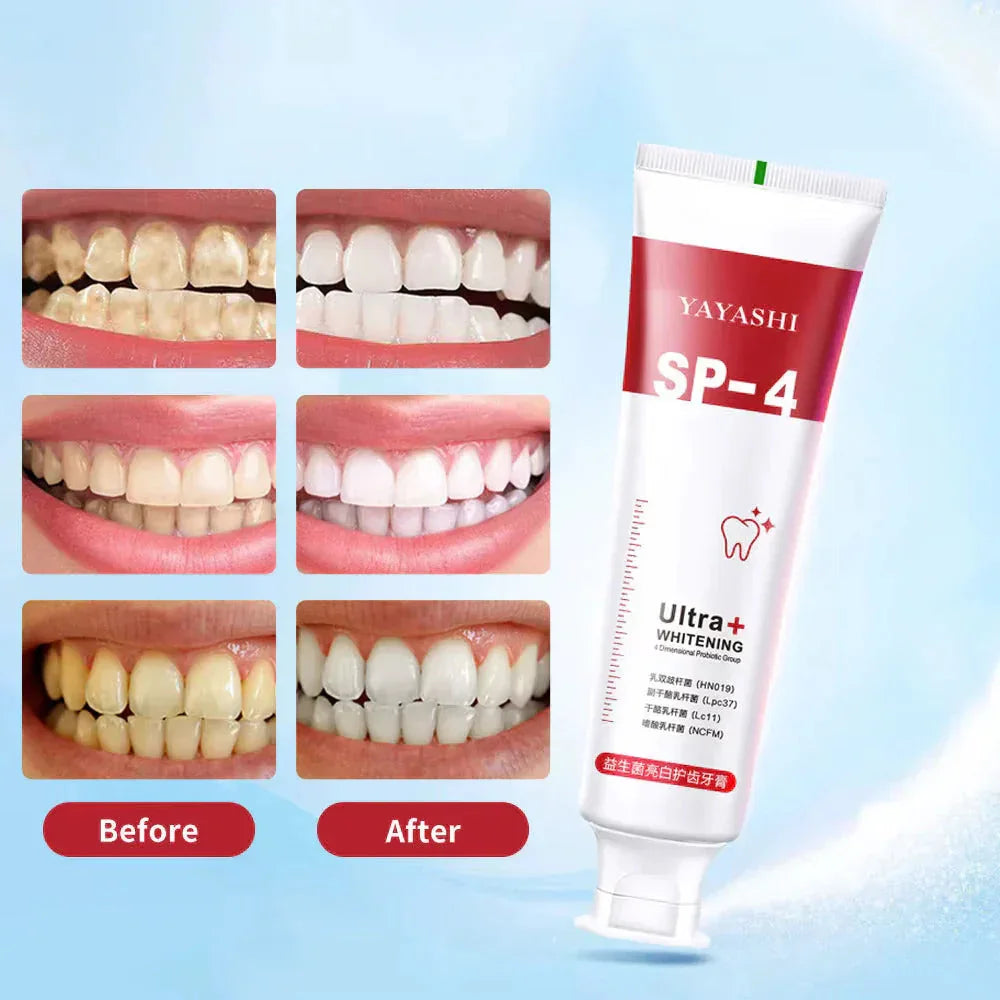 Yayashi SP4 Oral Care Probiotic Whitening Toothpaste 120g – Shine Brighter, Remove Years of Coffee, Tea & Smoking Stains Big Mart
