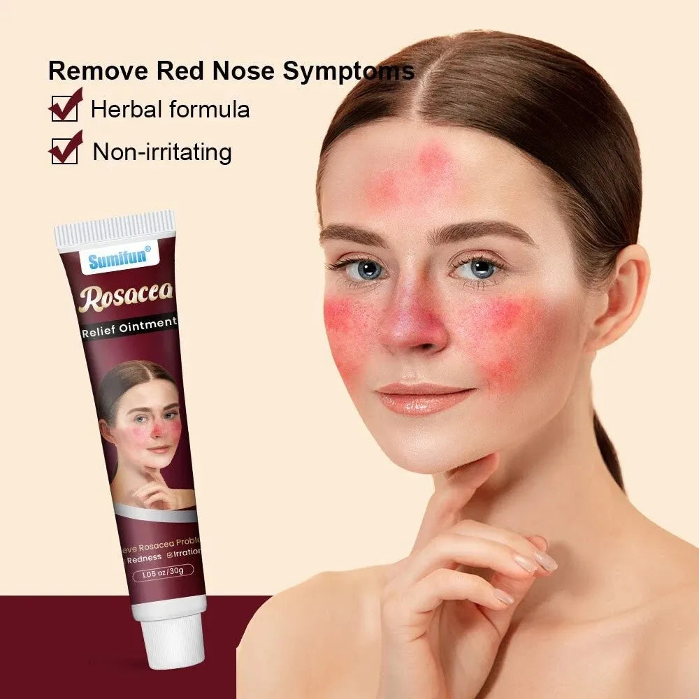 Sumifun - Rosacea Relief Ointment (Original)